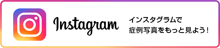 インスタグラム